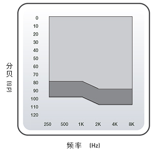 深耳道式助聽(tīng)器 CIC